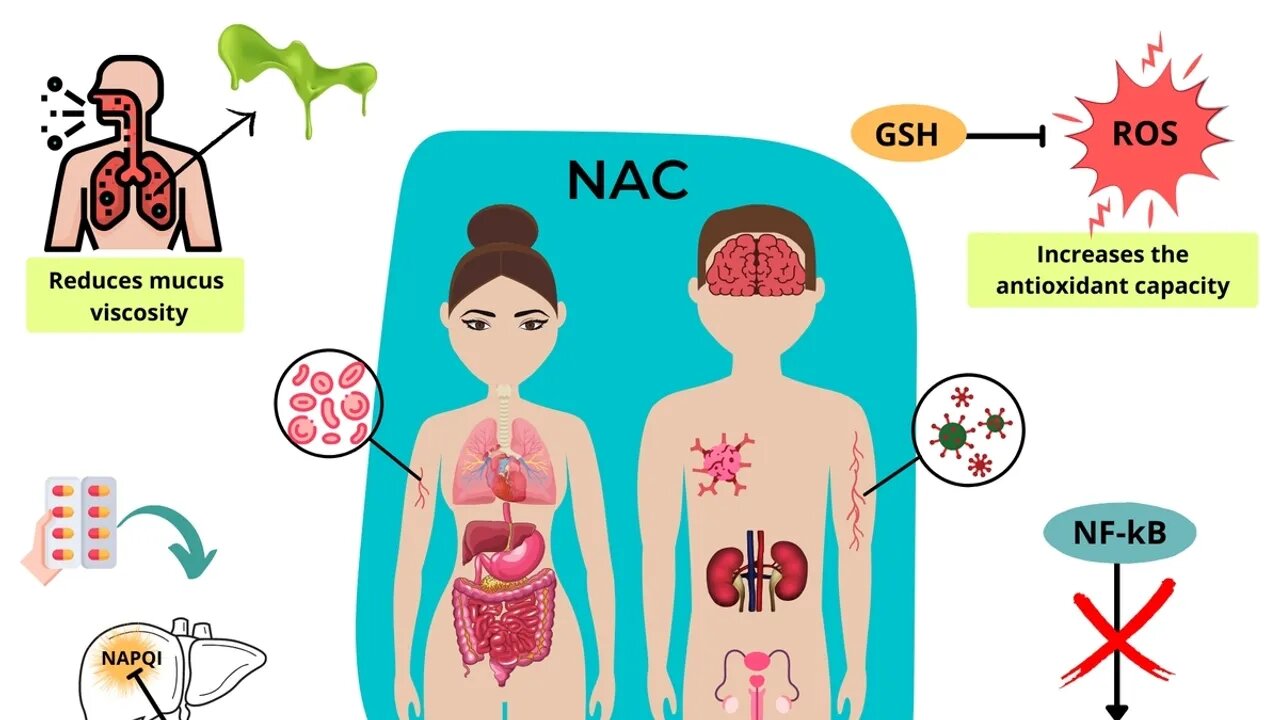 The Promising Role of N-Acetylcysteine in Pain Management and Opioid Reduction Post-Surgery